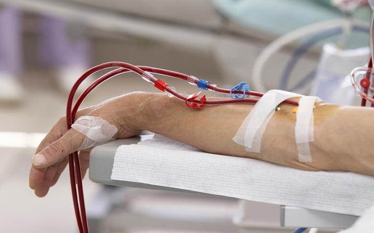 Kidney Failure Patients With High Antibodies May Now Get Transplant