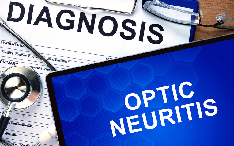 /sites/hexassets/Assets/eye-care/optic-neuritis-causes-symptoms-treatment.jpg