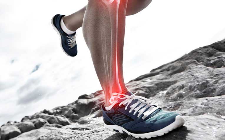 /sites/hexassets/Assets/fitness-exercise/shin-splints-symptoms-and-causes.jpg