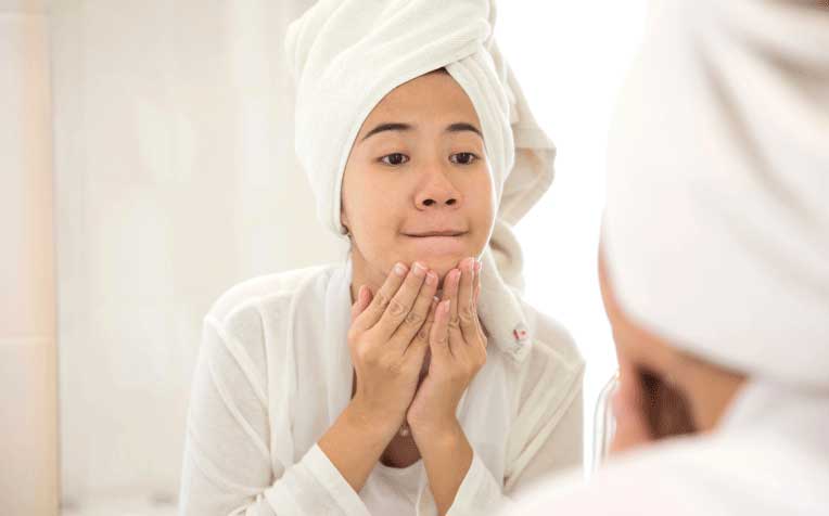 ​​​​​​Acne and Pimples in Teenagers: Causes