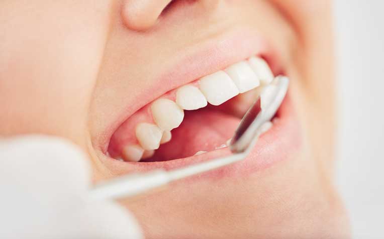 ​Dental FAQs:Dental Treatments