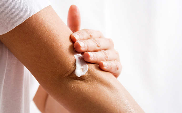 How To Manage Hives (Urticaria) and Angioedema