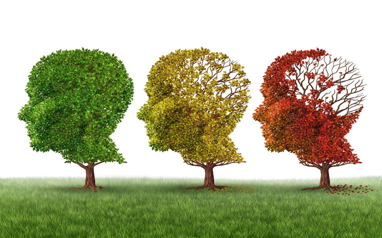 4 Major Causes of Young Onset Dementia