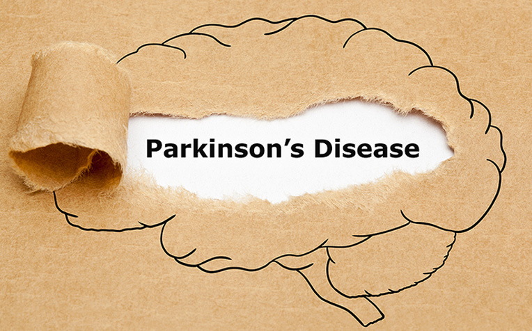 /sites/hexassets/Assets/head-neck/parkinsons-disease-five-common-myths-debunked.jpg