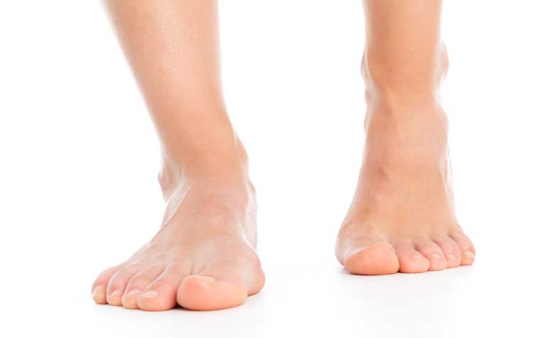 Sensory Peripheral Neuropathy: Signs and Symptoms