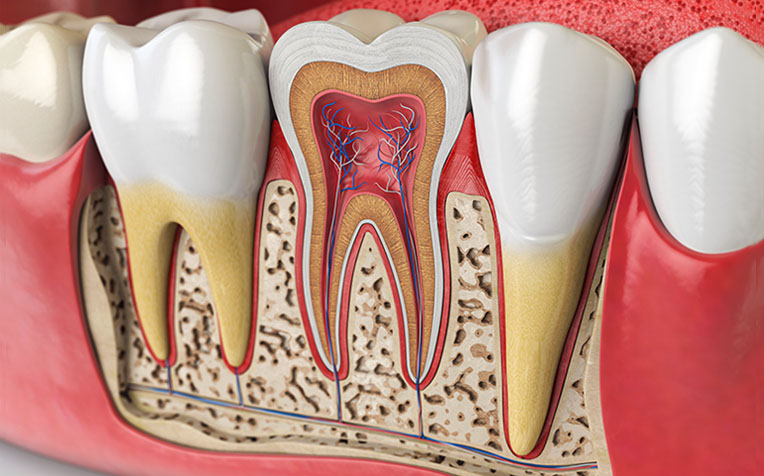 Root Canal Treatment Is It Painful?