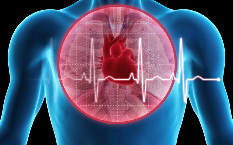 Angioplasty: Coronary Artery Disease Treatment