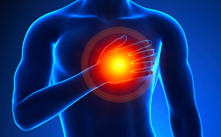 Medication to Manage Chest Pain (Angina)