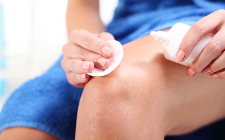 ​How to Clean and Treat a Skin Wound​