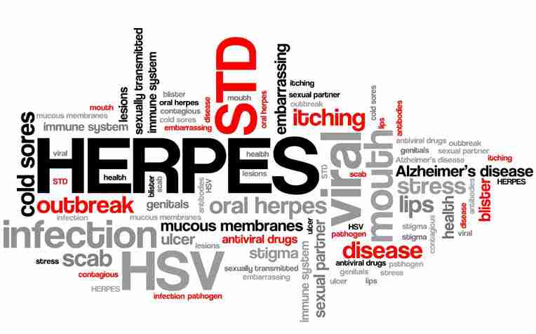 Genital herpes of Genital Herpes