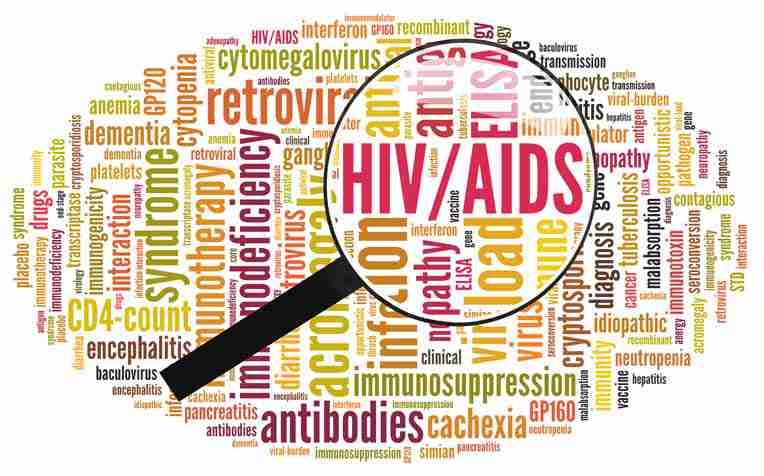 ​HIV/AIDS: Symptoms, Complications, Treatments