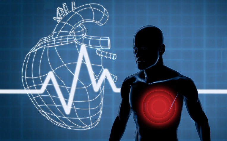 Atrial Fibrillation: How do you reduce the risks?