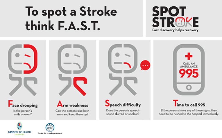  ​Think FAST to Spot a Stroke