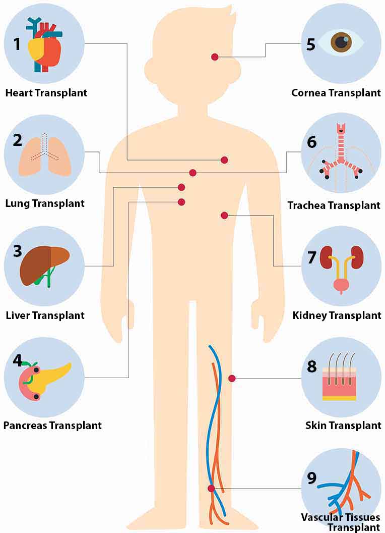 Types of Organ Transplants   HealthXchange