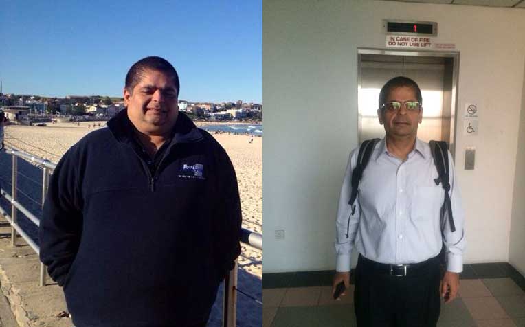 Bariatric Surgery Changed His Life