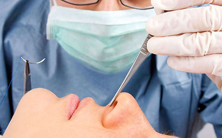 Broken Nose: When is Surgery Necessary?