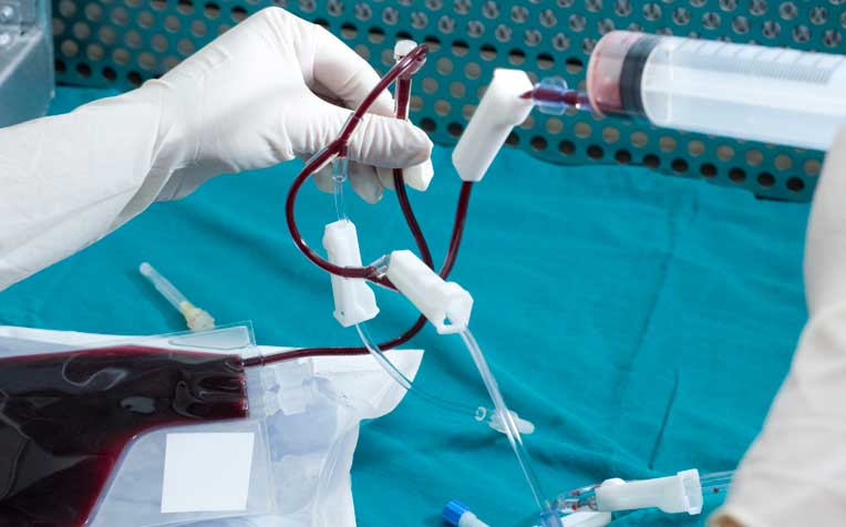 Cord Blood: 5 Things You Need to Know About It