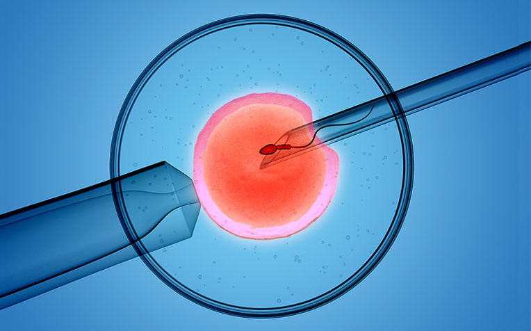  ​IVF (In-Vitro Fertilisation) When Is It Necessary? 