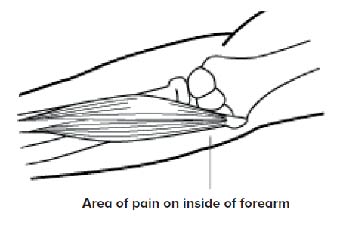 Golfer's Elbow - SingHealth Duke-NUS Sport & Exercise Medicine