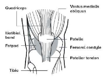 Jumper's Knee  - SingHealth Duke-NUS Sport & Exercise Medicine