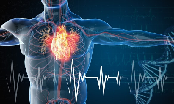 Acute Aortic Syndrome – SingHealth Duke-NUS Vascular Centre