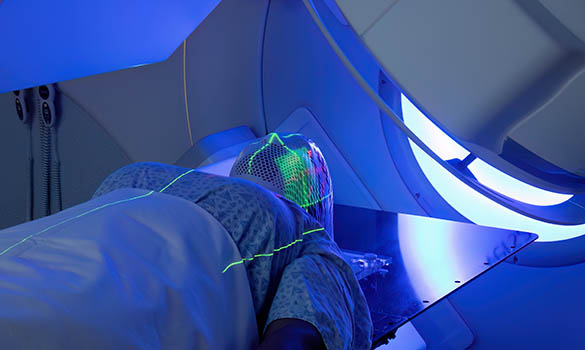 Proton Therapy: An Innovative Radiotherapy Treatment Offered at the National Cancer Centre Singapore - NCCS