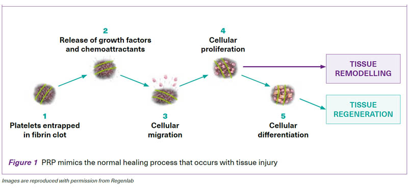 Crucial role of platelets-SingHealth Duke-NUS Sport & Exercise Medicine Centre