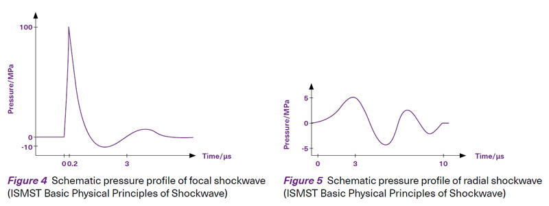 Types of shockwaves - SingHealth Duke-NUS Sport & Exercise Medicine Centre