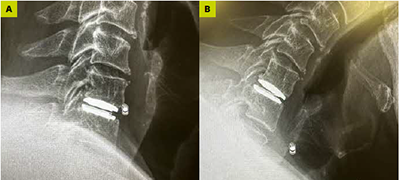 DCM - SingHealth Duke-NUS Spine Centre