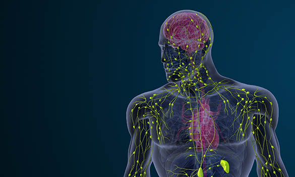 Understanding and Managing Lymphoedema - SKH