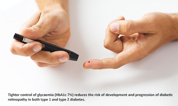 Treatment of diabetic retinopathy in Singapore.