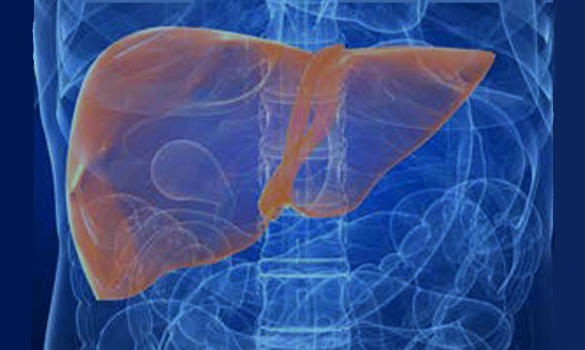 The Link Between Obesity and Non-Alcoholic Fatty Liver Disease - SGH