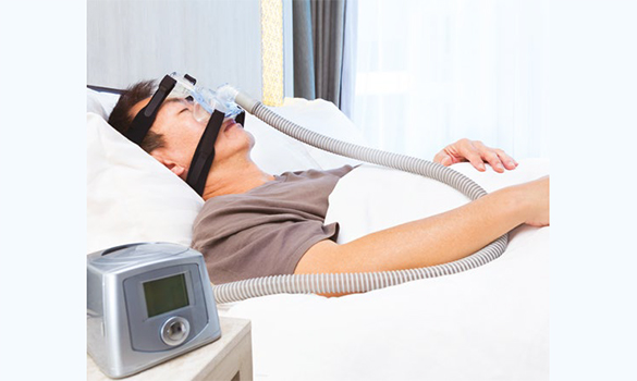 Persistent Sleepiness in OSA After CPAP