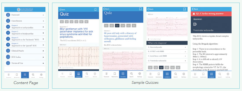 ECG App teaching tool - National Heart Centre Singapore