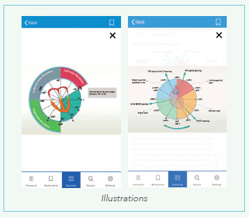 ECG App Illustration - National Heart Centre Singapore