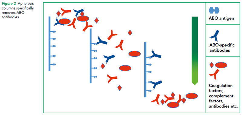 Apheresis columns specifically removes ABO antibodies - SGH