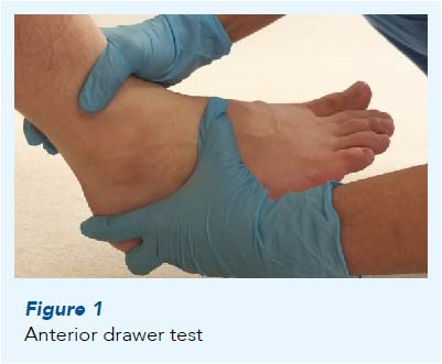 Anterior Drawer Test