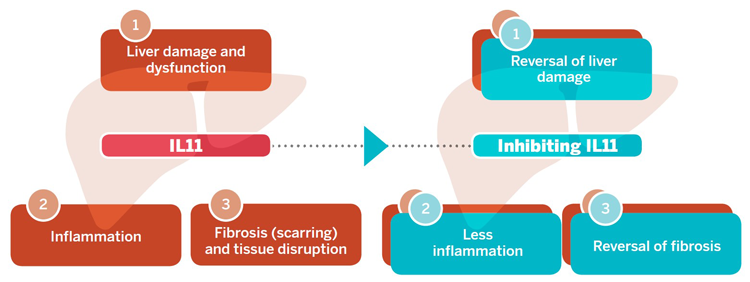 IL-11 and liver damage