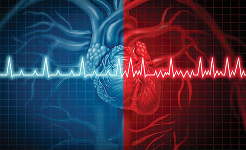 Atrial Fibrillation