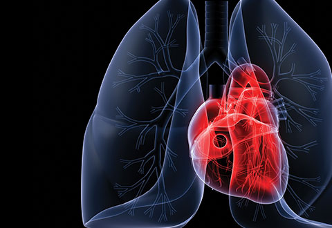 ECMO heart illustration