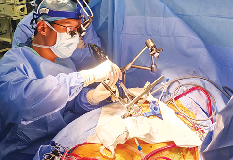Double Feat - Minimally Invasive Double Valve Surgery