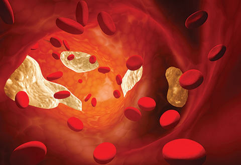 blood clotting