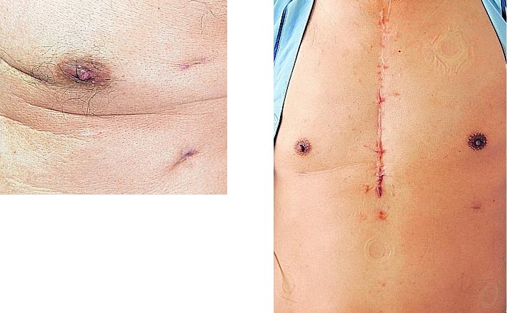 /sites/shcommonassets/Assets/News/NHCS/NHCS%20news%20articles/ST290308RoboticSurgery2.jpg