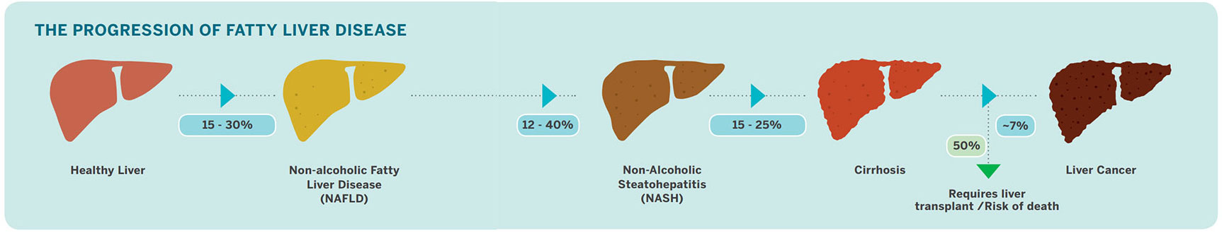 fatty liver disease progression