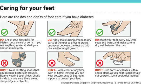 Caring for your feet