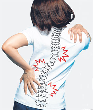 KKH, SGH, CGH doctors on scoliosis