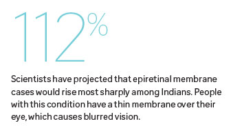 SNEC and Duke-NUS study shows spike in eye-disease in the next two decades