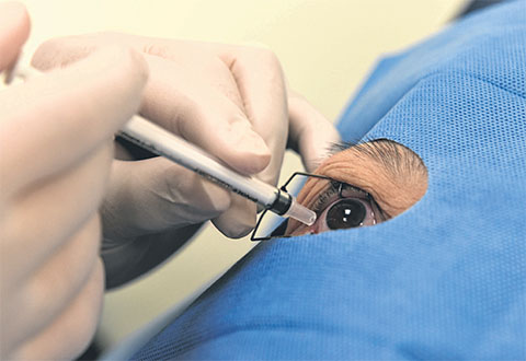 Oral drug and eye injections effective against diabetic retinopathy and macular oedema - SNEC