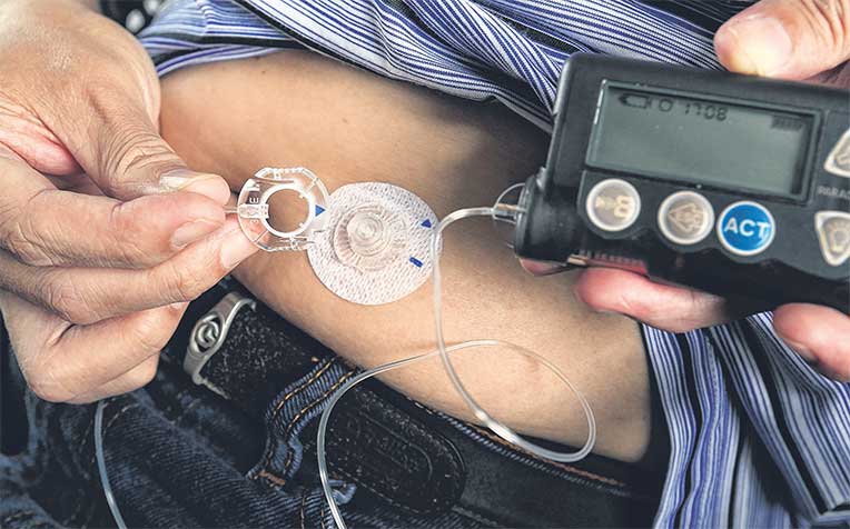 /sites/shcommonassets/Assets/News/fewer-jabs-with-insulin-pump.jpg