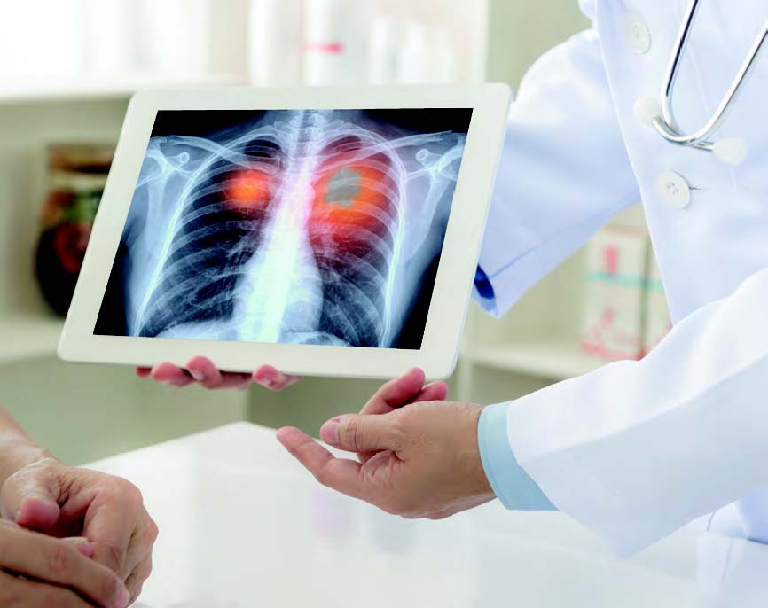 /sites/shcommonassets/Assets/SingaporeHealth/2020/Jan-Feb%202020/18%20Healthwatch%20-%20COPD%20LR%20main.jpg